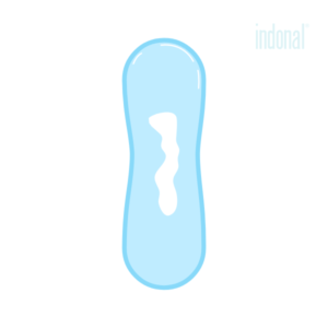 Biely výtok: kedy je normálny a kedy signalizuje problém? ako sa zbaviť bieleho výtoku? Biely výtok príčiny